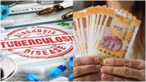 Read more about the article टीबी मरीजों पर मेहरबान मोहन सरकार! सहायता राशि हुई दोगुनी, अब हर माह मिलेंगे 1,000 रुपये