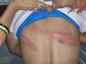 Read more about the article जबलपुर में भाजयुमो नेता की थाने में बेरहमी से पिटाई: पुलिस पर लगाए गंभीर आरोप, बोले- आधे घंटे जानवरों की तरह पीटा; पुलिस बोली- झूठे दावे!