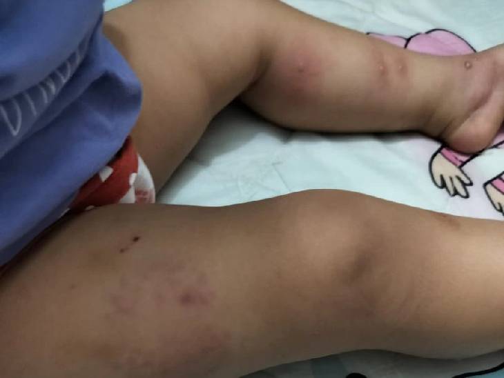 You are currently viewing सहायिका ने बच्ची को थप्पड़ और मुक्के मरे, फिर दीवार में फेंका: 15 माह की मासूम पर बर्बरता का CCTV फुटेज सामने आया, मां को जांघ पर निशान देखकर हुआ था शक; डे-केयर संचालिका और सहायिका पर केस दर्ज!