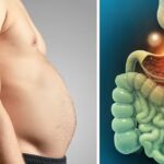 पेट फूलने और गैस की समस्या: जानें कारण और आसान उपाय