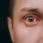 विटामिन D की कमी से घट सकती है आंखों की रोशनी, जानें लक्षण और बचाव के उपाय